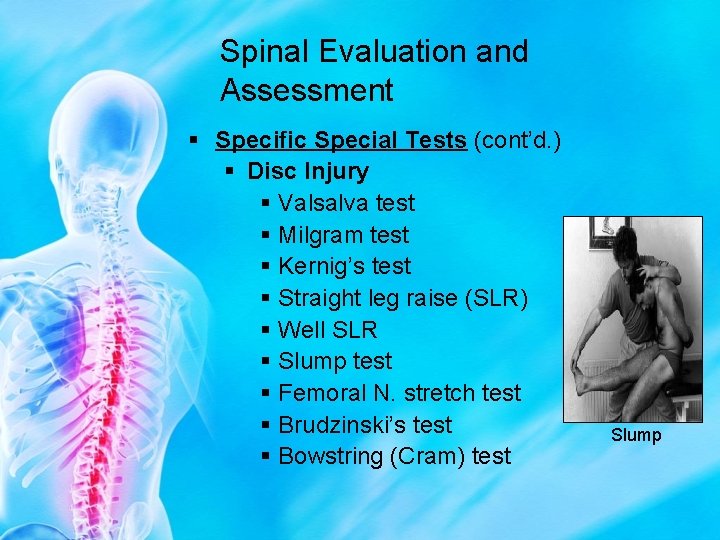 Spinal Evaluation and Assessment § Specific Special Tests (cont’d. ) § Disc Injury §