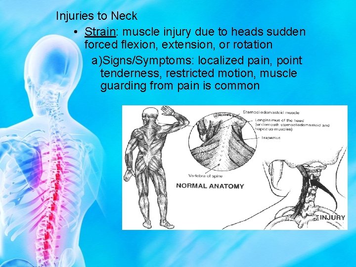 Injuries to Neck • Strain: muscle injury due to heads sudden forced flexion, extension,