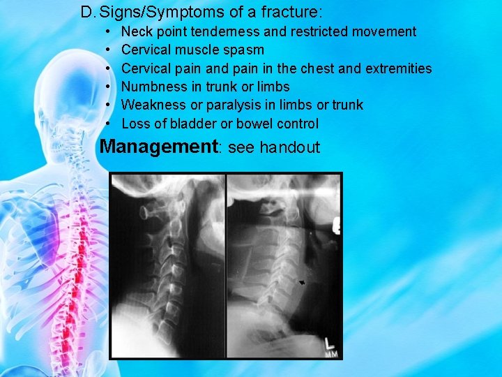 D. Signs/Symptoms of a fracture: • • • Neck point tenderness and restricted movement