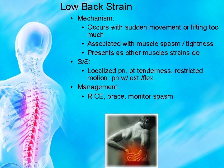 Low Back Strain • Mechanism: • Occurs with sudden movement or lifting too much