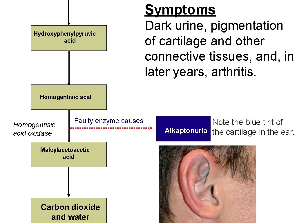 Symptoms Hydroxyphenylpyruvic acid Dark urine, pigmentation of cartilage and other connective tissues, and, in