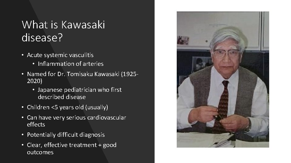 What is Kawasaki disease? • Acute systemic vasculitis • Inflammation of arteries • Named