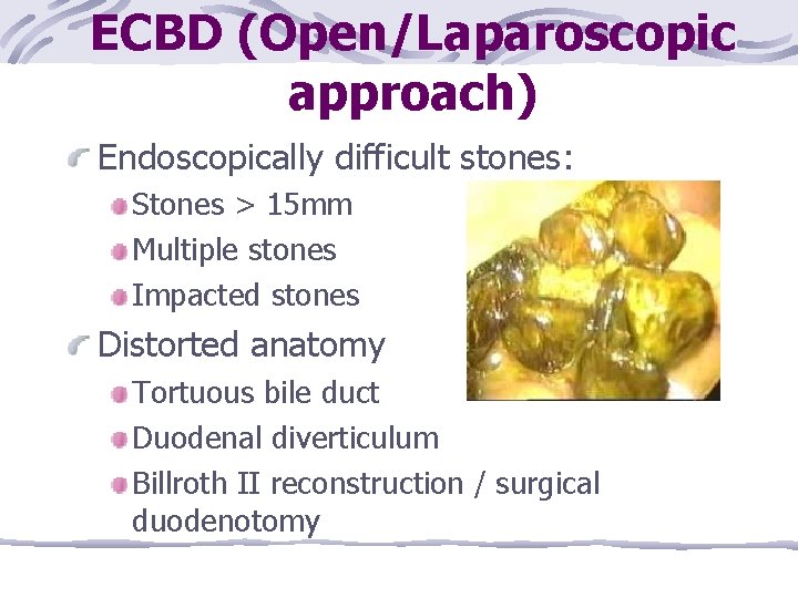 ECBD (Open/Laparoscopic approach) Endoscopically difficult stones: Stones > 15 mm Multiple stones Impacted stones