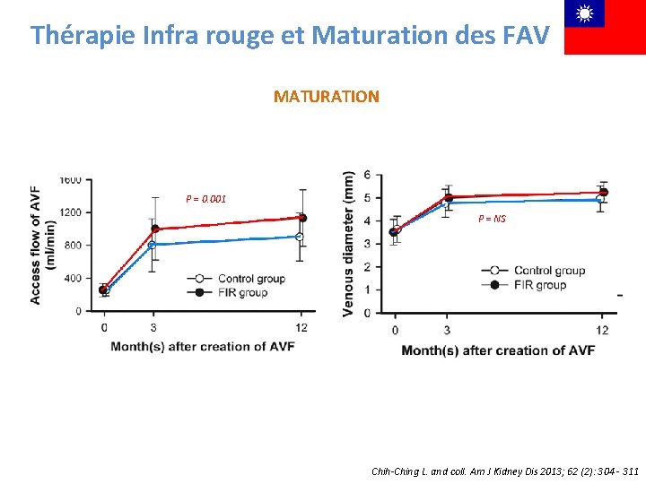 Thérapie Infra rouge et Maturation des FAV MATURATION P = 0. 001 P =