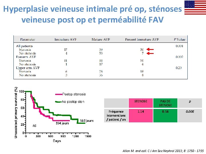 Hyperplasie veineuse intimale pré op, sténoses veineuse post op et perméabilité FAV NS 354