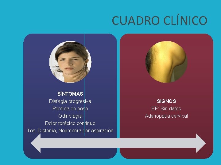 CUADRO CLÍNICO SÍNTOMAS Disfagia progresiva Pérdida de peso Odinofagia Dolor torácico continuo Tos, Disfonía,