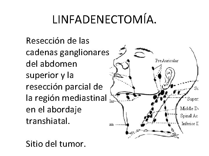 LINFADENECTOMÍA. Resección de las cadenas ganglionares del abdomen superior y la resección parcial de