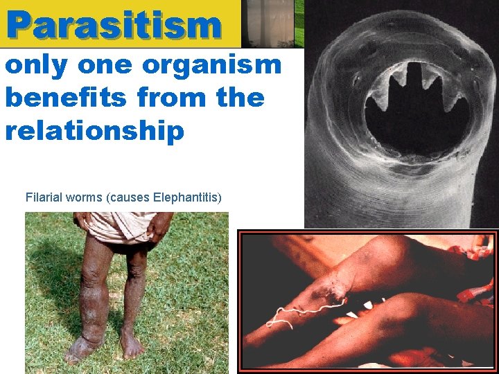 Parasitism only one organism benefits from the relationship Filarial worms (causes Elephantitis) 