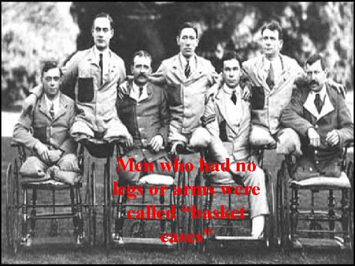 Men who had no legs or arms were called “basket cases” 