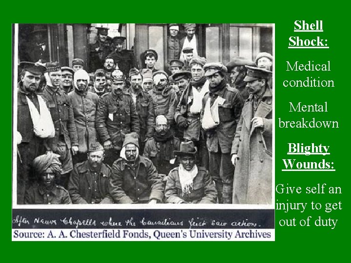 Shell Shock: Medical condition Mental breakdown Blighty Wounds: Give self an injury to get