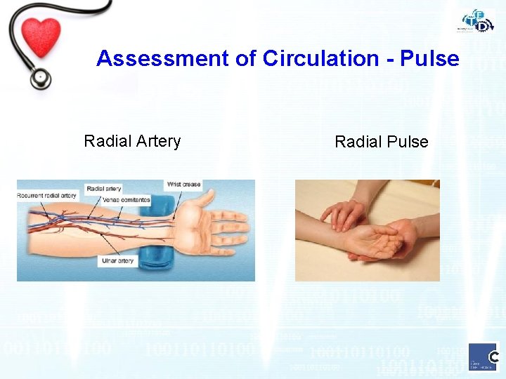 Assessment of Circulation - Pulse Radial Artery Radial Pulse 