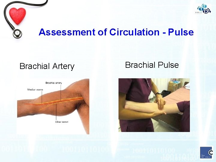 Assessment of Circulation - Pulse Brachial Artery Brachial Pulse 