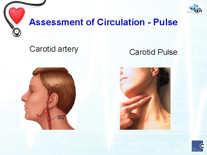 Assessment of Circulation - Pulse Carotid artery Carotid Pulse 