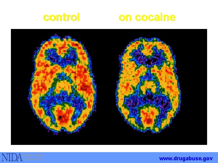 control on cocaine www. drugabuse. gov 