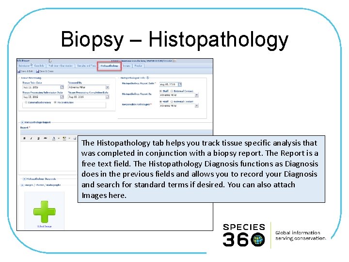 Biopsy – Histopathology The Histopathology tab helps you track tissue specific analysis that was