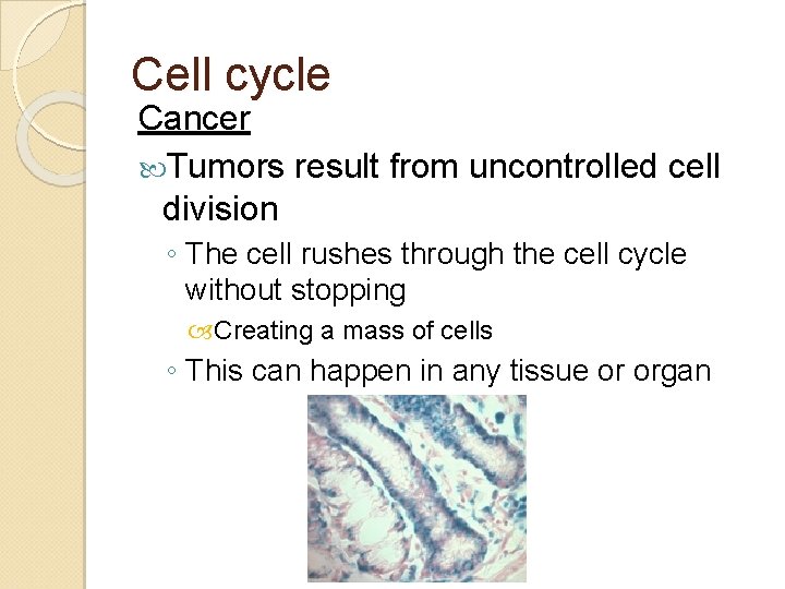 Cell cycle Cancer Tumors result from uncontrolled cell division ◦ The cell rushes through