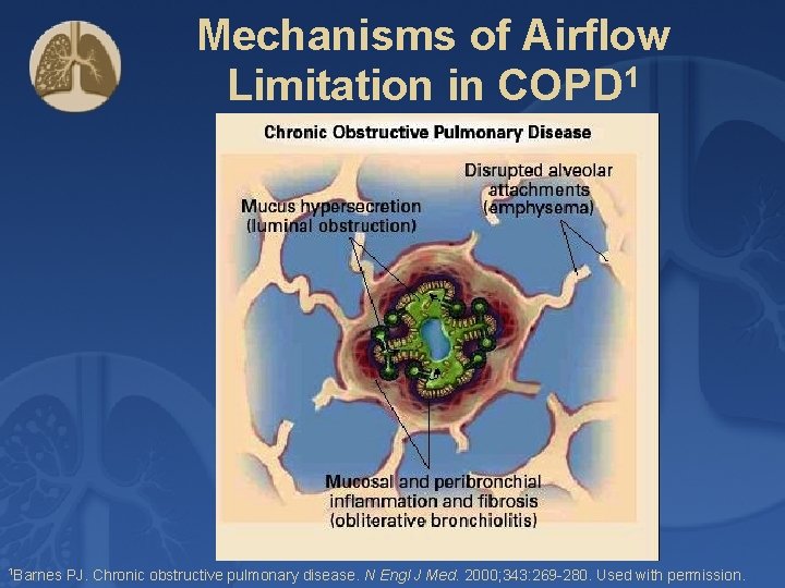 Mechanisms of Airflow Limitation in COPD 1 1 Barnes PJ. Chronic obstructive pulmonary disease.