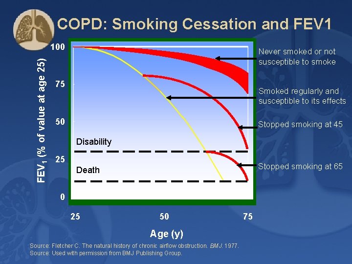 COPD: Smoking Cessation and FEV 1 (% of value at age 25) 100 Never