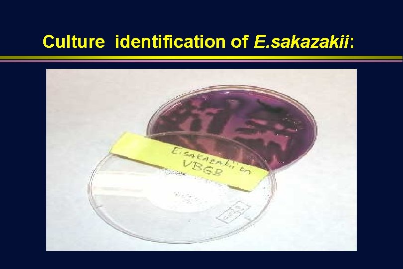 Culture identification of E. sakazakii: 