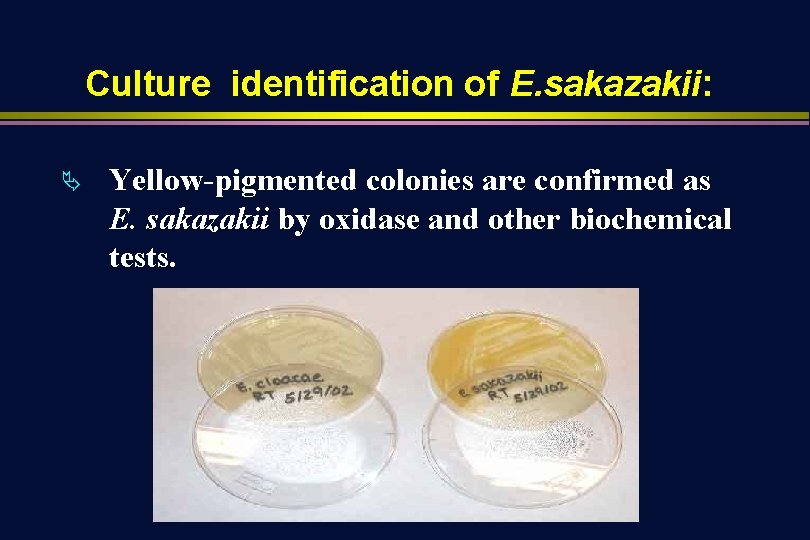 Culture identification of E. sakazakii: Ä Yellow-pigmented colonies are confirmed as E. sakazakii by