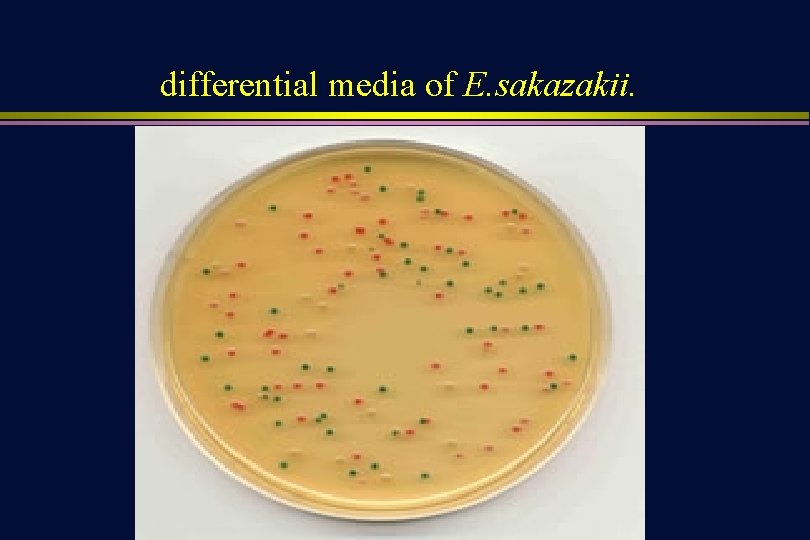 differential media of E. sakazakii. 