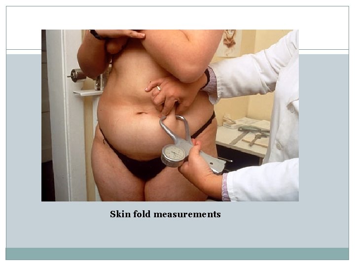 Skin fold measurements 