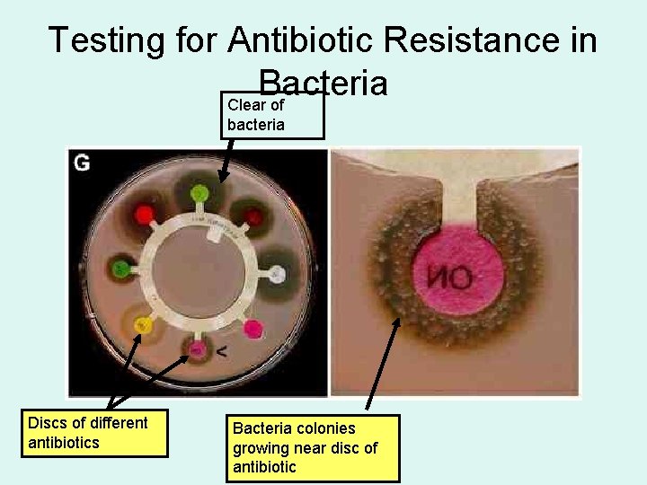 Testing for Antibiotic Resistance in Bacteria Clear of bacteria Discs of different antibiotics Bacteria