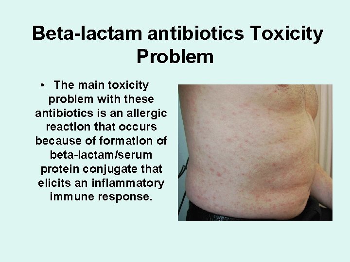 Beta-lactam antibiotics Toxicity Problem • The main toxicity problem with these antibiotics is an