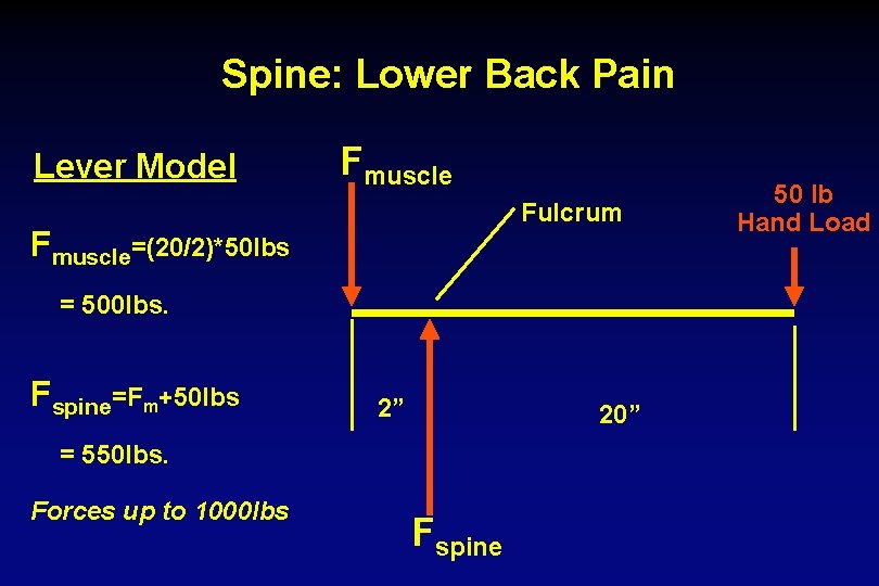 Spine: Lower Back Pain Lever Model Fmuscle Fulcrum Fmuscle=(20/2)*50 lbs = 500 lbs. Fspine=Fm+50