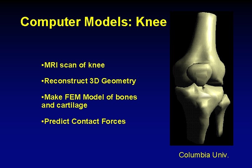 Computer Models: Knee • MRI scan of knee • Reconstruct 3 D Geometry •