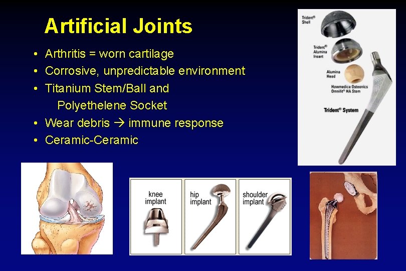 Artificial Joints • Arthritis = worn cartilage • Corrosive, unpredictable environment • Titanium Stem/Ball
