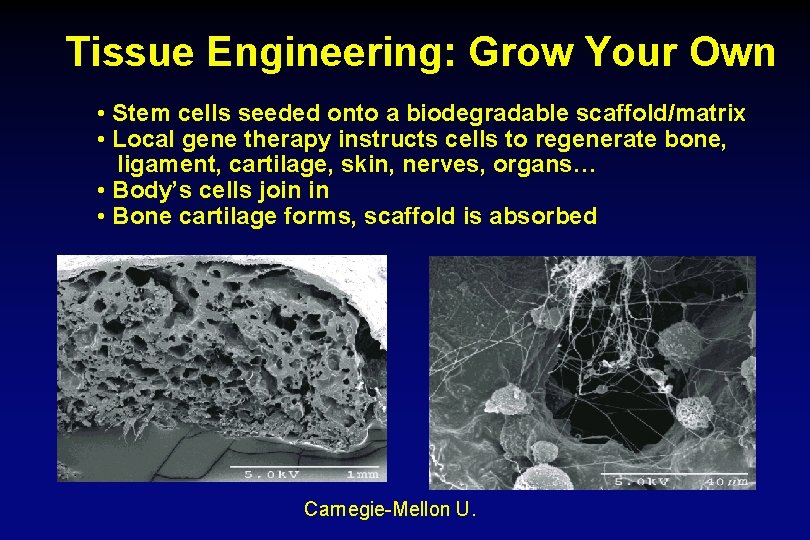 Tissue Engineering: Grow Your Own • Stem cells seeded onto a biodegradable scaffold/matrix •