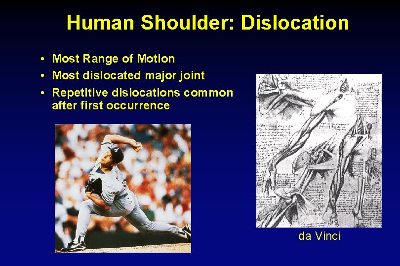 Human Shoulder: Dislocation • Most Range of Motion • Most dislocated major joint •