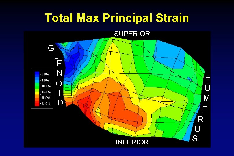 Total Max Principal Strain SUPERIOR G L E N O I D INFERIOR H