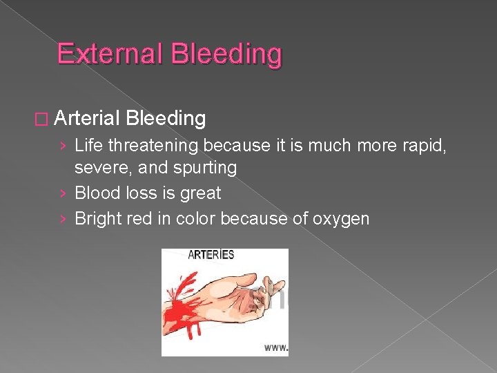 External Bleeding � Arterial Bleeding › Life threatening because it is much more rapid,