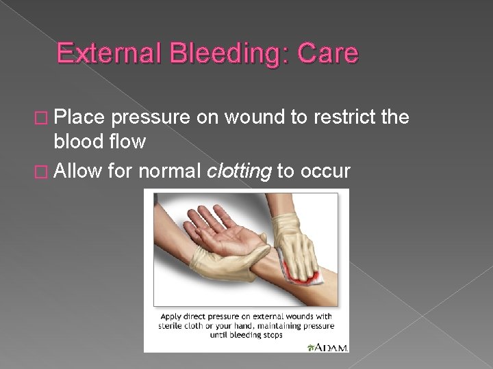 External Bleeding: Care � Place pressure on wound to restrict the blood flow �