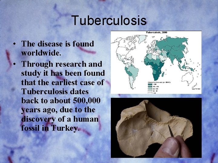 Tuberculosis • The disease is found worldwide. • Through research and study it has