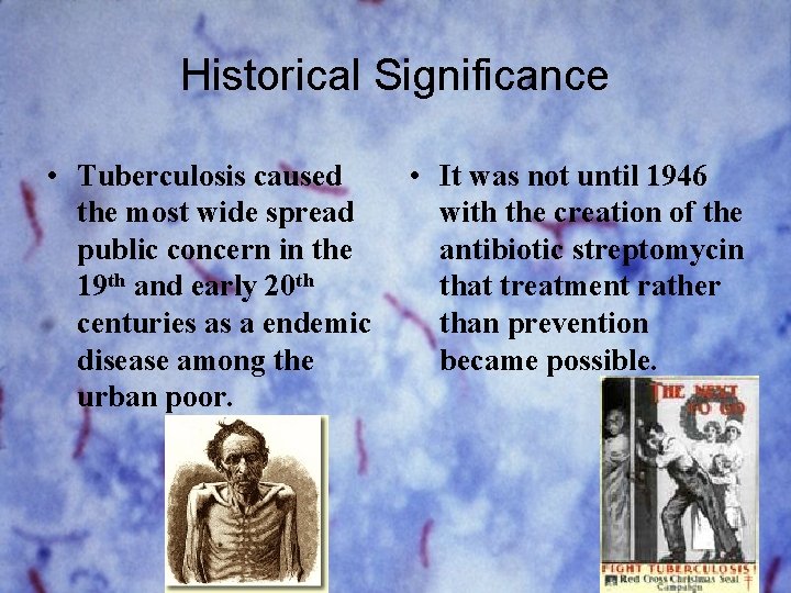 Historical Significance • Tuberculosis caused the most wide spread public concern in the 19