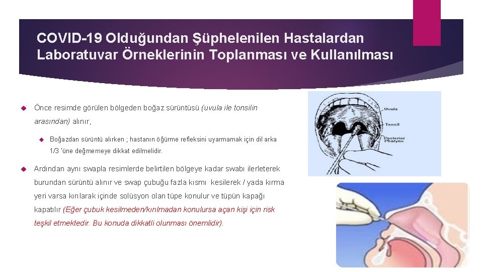 COVID-19 Olduğundan Şüphelenilen Hastalardan Laboratuvar Örneklerinin Toplanması ve Kullanılması Önce resimde görülen bölgeden boğaz