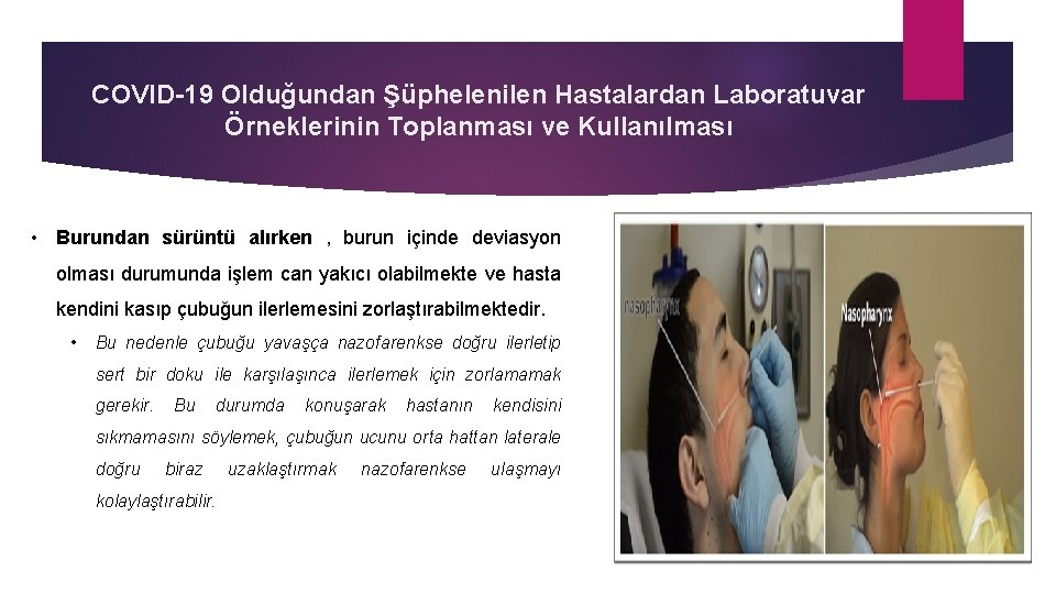 COVID-19 Olduğundan Şüphelenilen Hastalardan Laboratuvar Örneklerinin Toplanması ve Kullanılması • Burundan sürüntü alırken ,