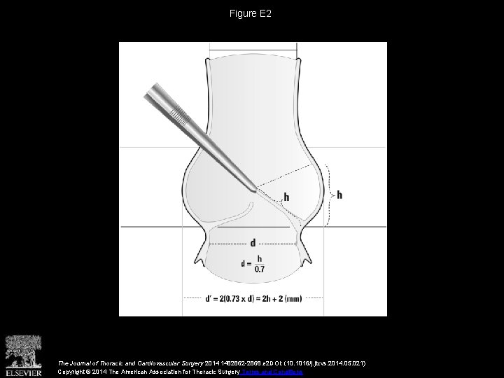 Figure E 2 The Journal of Thoracic and Cardiovascular Surgery 2014 1482862 -2868. e