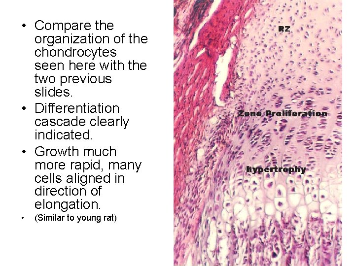  • Compare the organization of the chondrocytes seen here with the two previous