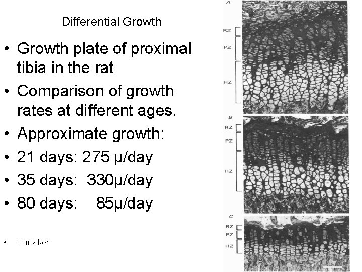 Differential Growth • Growth plate of proximal tibia in the rat • Comparison of