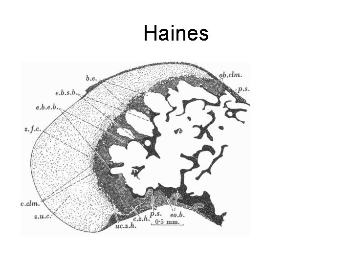 Haines 