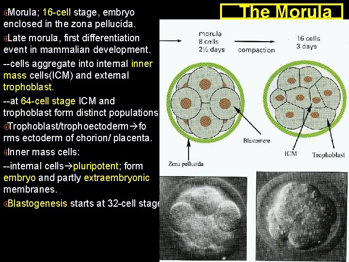  Morula; 16 -cell stage, embryo enclosed in the zona pellucida. Late morula, first