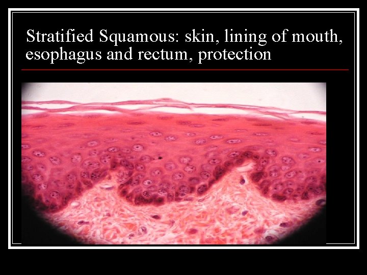 Stratified Squamous: skin, lining of mouth, esophagus and rectum, protection 