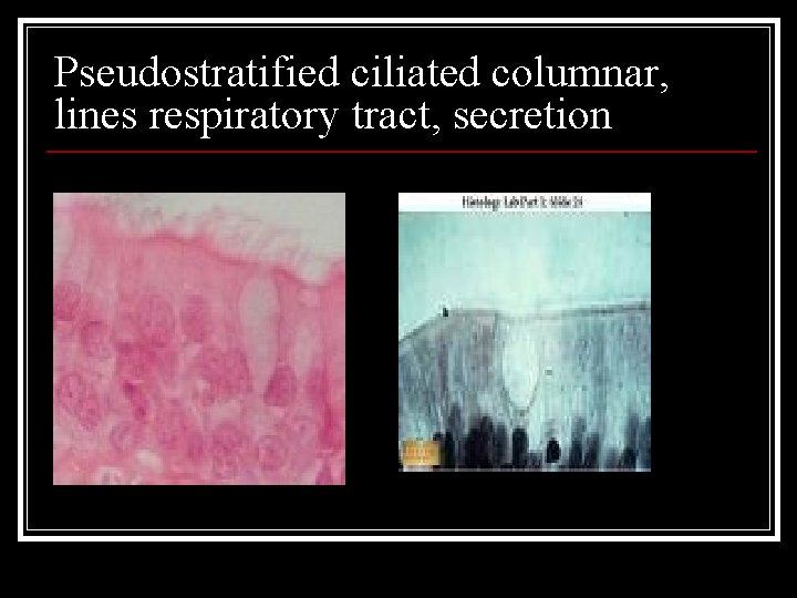 Pseudostratified ciliated columnar, lines respiratory tract, secretion 