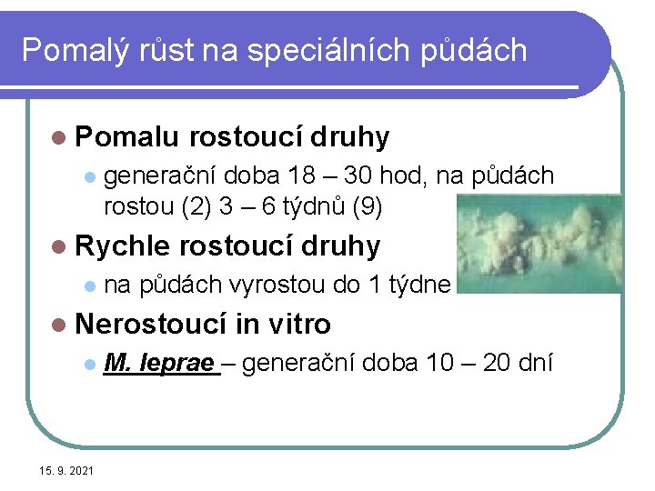 Pomalý růst na speciálních půdách l Pomalu l generační doba 18 – 30 hod,