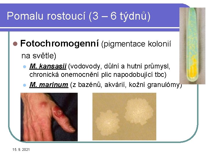 Pomalu rostoucí (3 – 6 týdnů) l Fotochromogenní (pigmentace kolonií na světle) l l