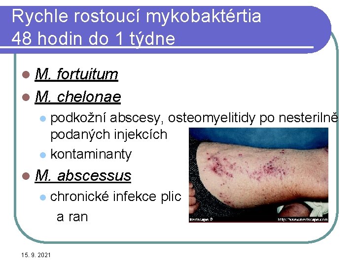 Rychle rostoucí mykobaktértia 48 hodin do 1 týdne l M. fortuitum l M. chelonae